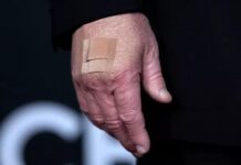 VIRAL: Ο Ντόναλντ Τραμπ με επίδεσμο στο χέρι – Οι φωτογραφίες που κάνουν το γύρο του διαδικτύου