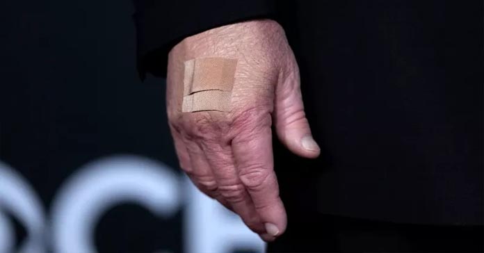 VIRAL: Ο Ντόναλντ Τραμπ με επίδεσμο στο χέρι – Οι φωτογραφίες που κάνουν το γύρο του διαδικτύου