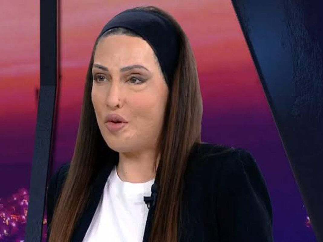 ΙΩΑΝΝΑ ΠΑΛΙΟΣΠΥΡΟΥ: Σοκαριστικό μήνυμα – «Καλά σου έκανε και σου έριξε βιτριόλι»
